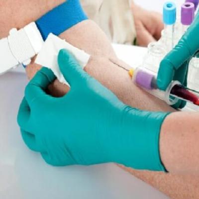 Blood test - what you need to know before donating blood for tests